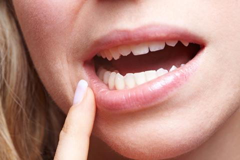 Is gingivitis preventable?